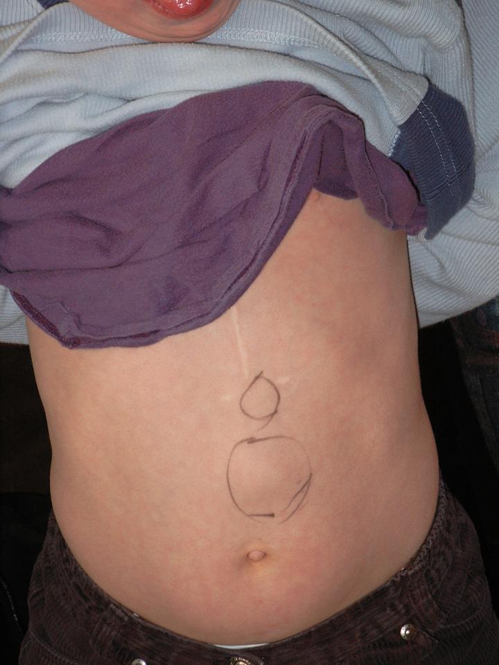 Was bedeutet es fr ein Kind, wenn es für ein Verhalten, an dem es nicht Schuld war
   und das   ursächlich an Bauchschmerzen gekoppelt war,
  immer wieder auf dieselbe Weise bestraft wird? Welche Bedeutung bekommt diese Art der Strafe
  bei echten Fehlverhalten? - Wird er dann Bauchschmerzen bekommen? Wird er die Strafe als
  Strafe erkennen? Wird er sein Verhalten verändern oder sich vielmehr genau wie früher
  verkrampfen? 